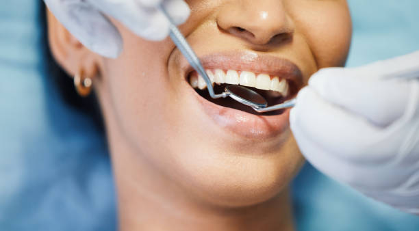 Best Emergency Dental Care for Broken or Chipped Teeth in Shingletown, CA